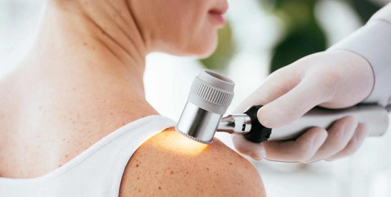 Powiat słupski odwołał badania profilaktyczne dotyczące raka skóry